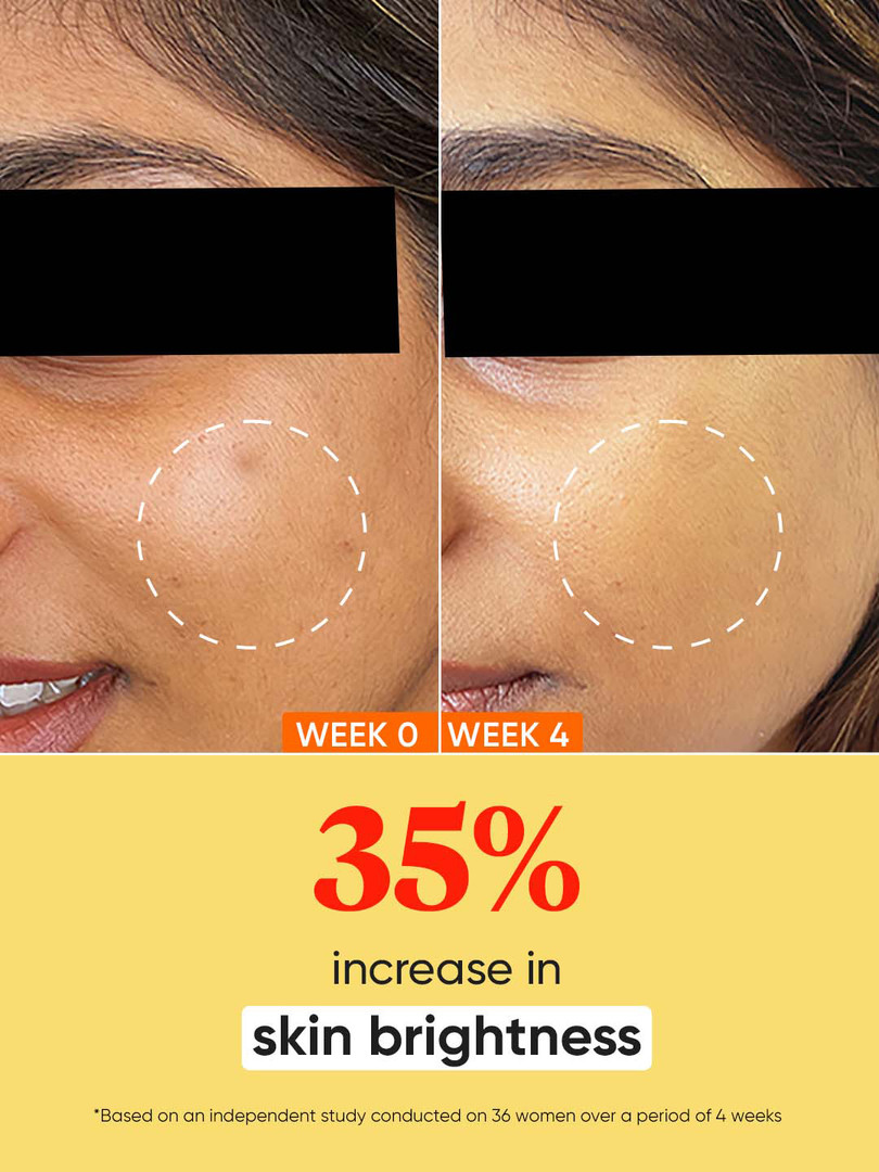 DOT & KEY Vitamin C+E Oil-Free Moisturizer For Glowing Skin & Fades Dark Spots - 25ml
