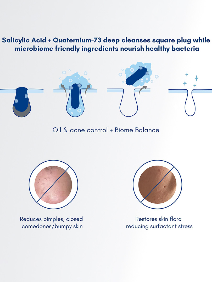 Becalm Oily Skin Soap Free Salicylic Acid Airy Face Wash - 80 ml
